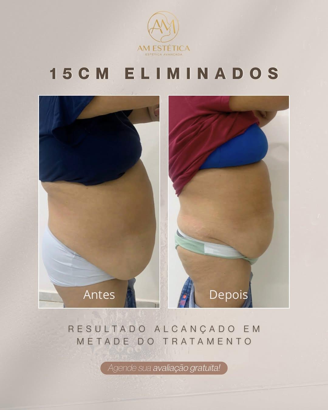 Instagram post by @adrielle.m_esteticista