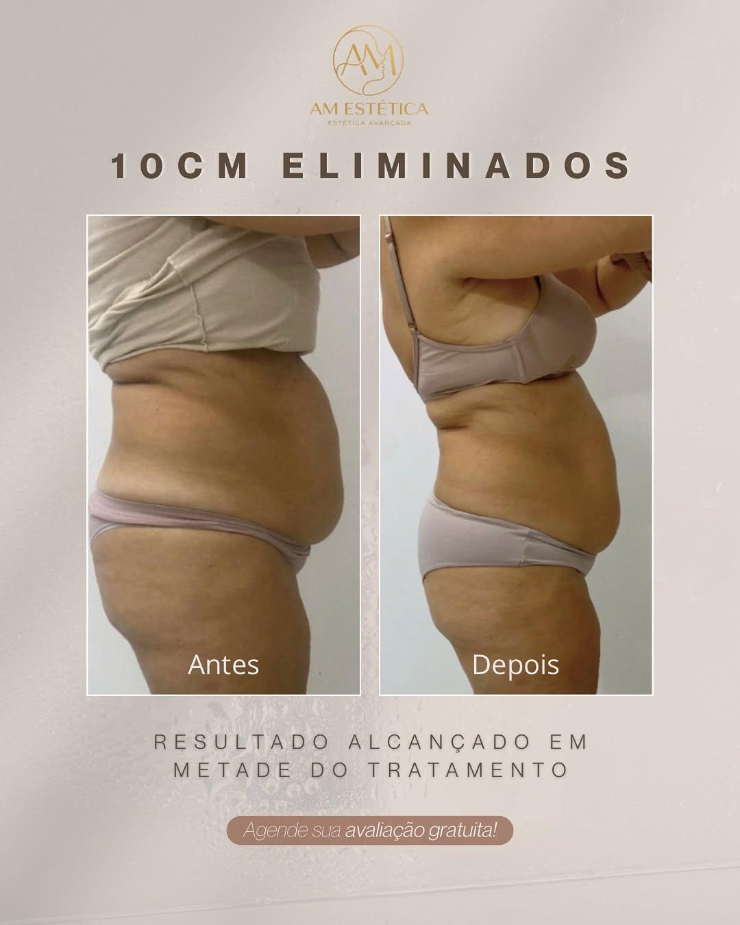 Instagram post by @adrielle.m_esteticista