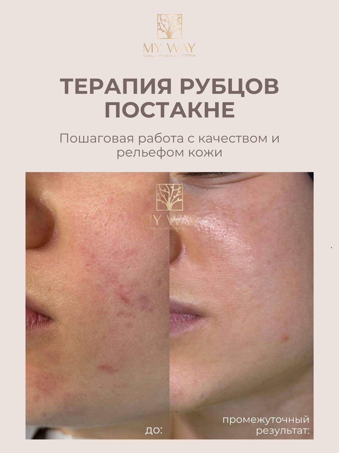 Instagram post by @beauty.my.way