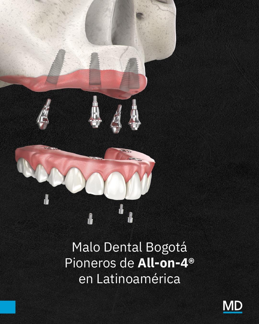 Instagram post by @malodentalbogota
