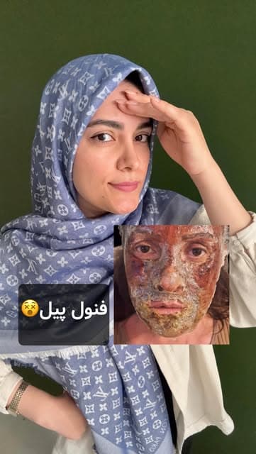 Instagram post by @yaramohamadii