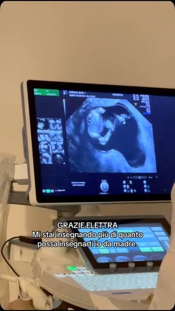 @giuliaanibaldi's Instagram post posted on date 7/9/2026 which generated 2148 likes and 37 comments