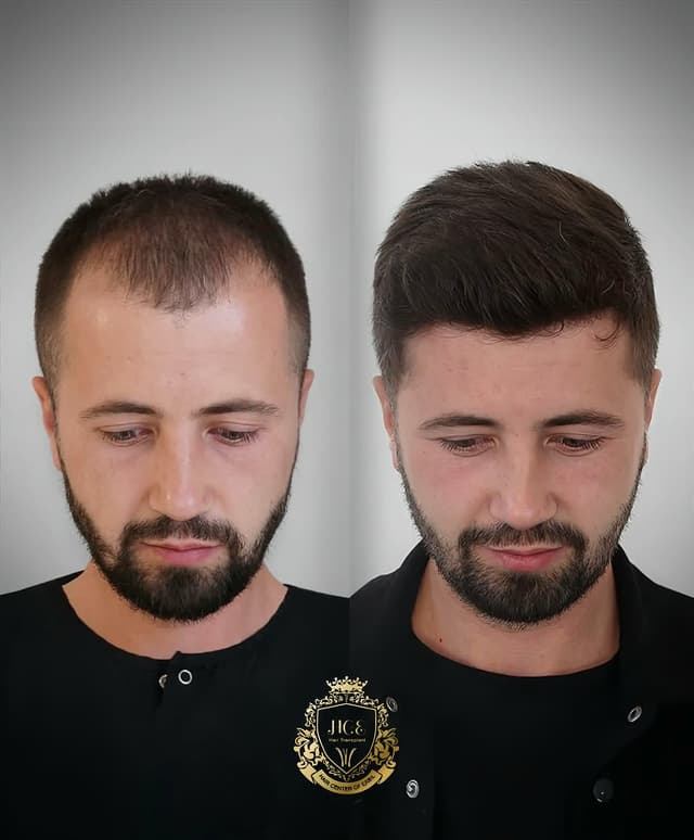@hair.vip.arzheen's Instagram post posted on date 7/3/2025 which generated 3 likes and 0 comments