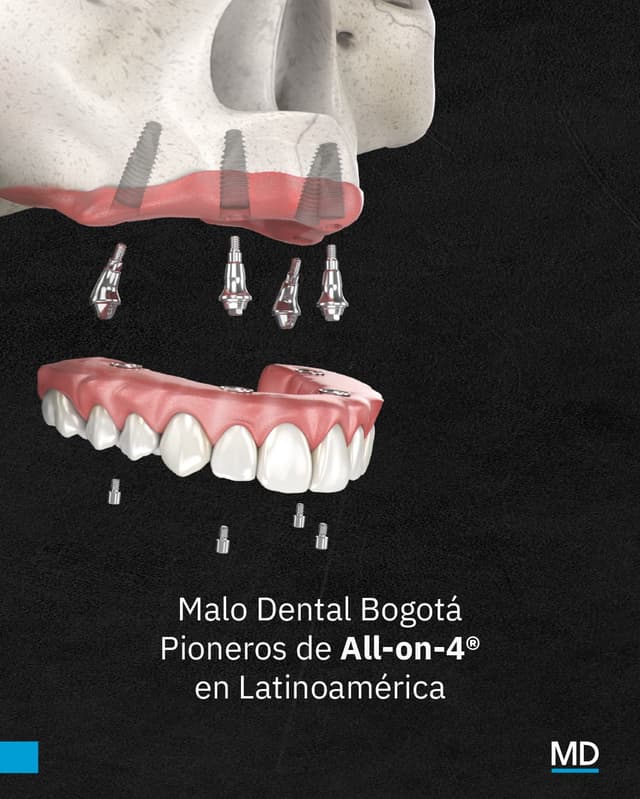 @malodentalbogota's Instagram post posted on date 1/15/2026 which generated 26 likes and 0 comments
