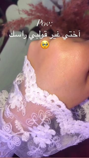 @siham__skin1's Instagram post posted on date 4/13/2026 which generated 3652 likes and 78 comments